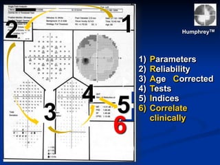 3
4 5
12 HumphreyTM
1) Parameters
2) Reliability
3) Age Corrected
4) Tests
5) Indices
6) Correlate
clinically
6
 