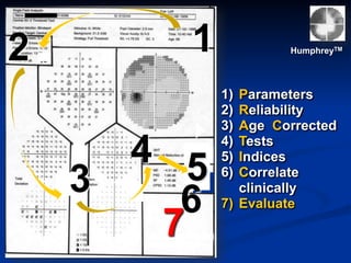 3
4 5
12 HumphreyTM
1) Parameters
2) Reliability
3) Age Corrected
4) Tests
5) Indices
6) Correlate
clinically
7) Evaluate6
7
 