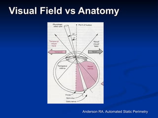 Visual Field vs Anatomy
Anderson RA. Automated Static Perimetry
 