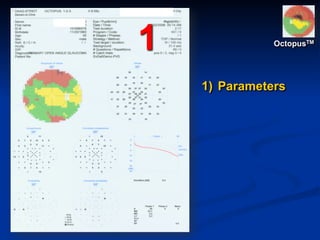 1
1) Parameters
OctopusTM
 