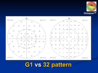 G1 vs 32 pattern
OctopusTM
 