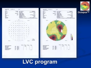 LVC program
OctopusTM
 