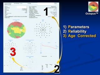 1
2
3
OctopusTM
1) Parameters
2) Reliability
3) Age Corrected
 