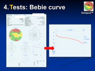 OctopusTM
4.Tests: Bebie curve
 