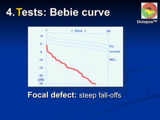 Focal defect: steep fall-offs
4.Tests: Bebie curve
OctopusTM
 