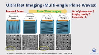 Ultrafast Imaging (Multi-angle Plane Waves)
M. Tanter, F. Mathias Fink,"Ultrafast imaging in biomedical ultrasound." IEEE UFFC, 2014.
No. of plane waves ↑
Imaging quality ↑
Frame rate ↓
Plane Wave Imaging
Focused Beam
 