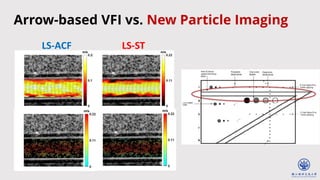 LS-ACF LS-ST
Arrow-based VFI vs. New Particle Imaging
 