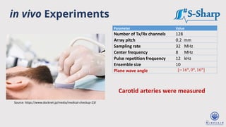 25
Parameter Value
Number of Tx/Rx channels 128
Array pitch 0.2 mm
Sampling rate 32 MHz
Center frequency 8 MHz
Pulse repetition frequency 12 kHz
Ensemble size 10
Plane wave angle [−16o
, 0o
, 16o
]
Source: https://www.docknet.jp/media/medical-checkup-23/
in vivo Experiments
Carotid arteries were measured
 