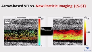 27
2mm
2mm
(LS-ST)
Arrow-based VFI vs. New Particle Imaging
 