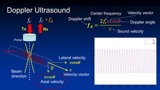 Probe
Beam
direction
Blood Flow
200 400 600 800 1000 1200 1400
-2
-1.5
-1
-0.5
0
0.5
1
1.5
2
Tx
Rx
𝑓𝑐 𝑓𝑐 +𝑓𝑑
Doppler Ultrasound
Tx Rx
𝒇𝒅 =
2𝑓𝑐𝑣𝑐𝑜𝑠𝜃
𝑐
Doppler shift
Velocity vector
Center frequency
Sound velocity
Doppler angle
Axial velocity
Lateral velocity
Velocity vector
𝜃
𝒗𝒔𝒊𝒏𝜽
𝒗𝒄𝒐𝒔𝜽
𝒗
 