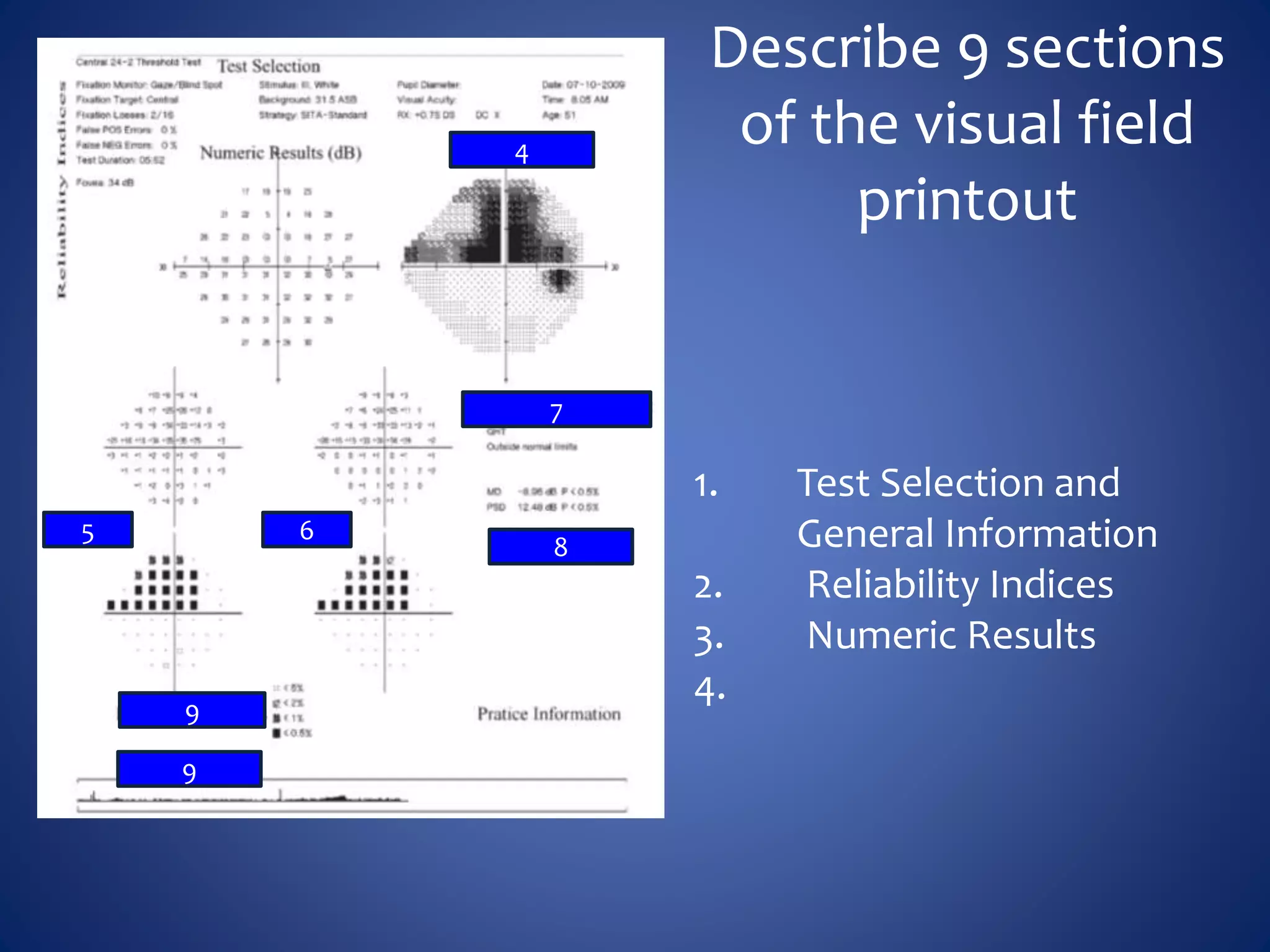Describe 9 sections
of the visual field
printout
1. Test Selection and
General Information
2. Reliability Indices
3. Numeric Results
4.
5
4
6
8
7
9
9
 