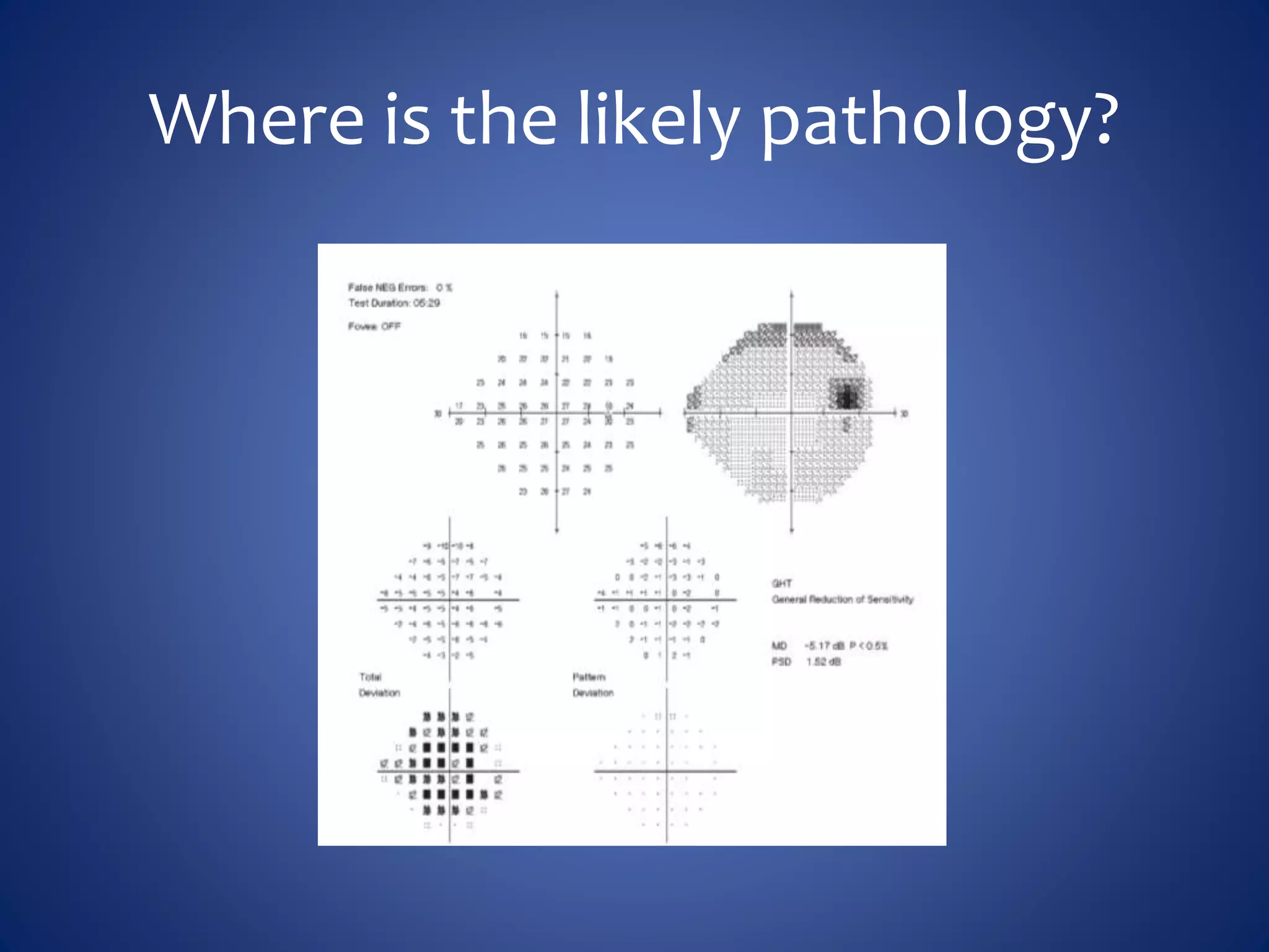 Where is the likely pathology?
 