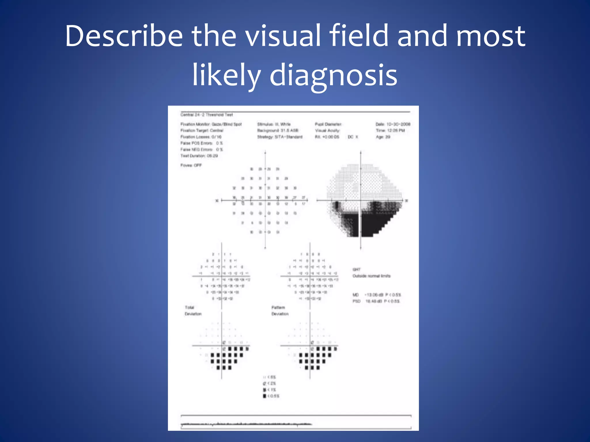 Describe the visual field and most
likely diagnosis
 