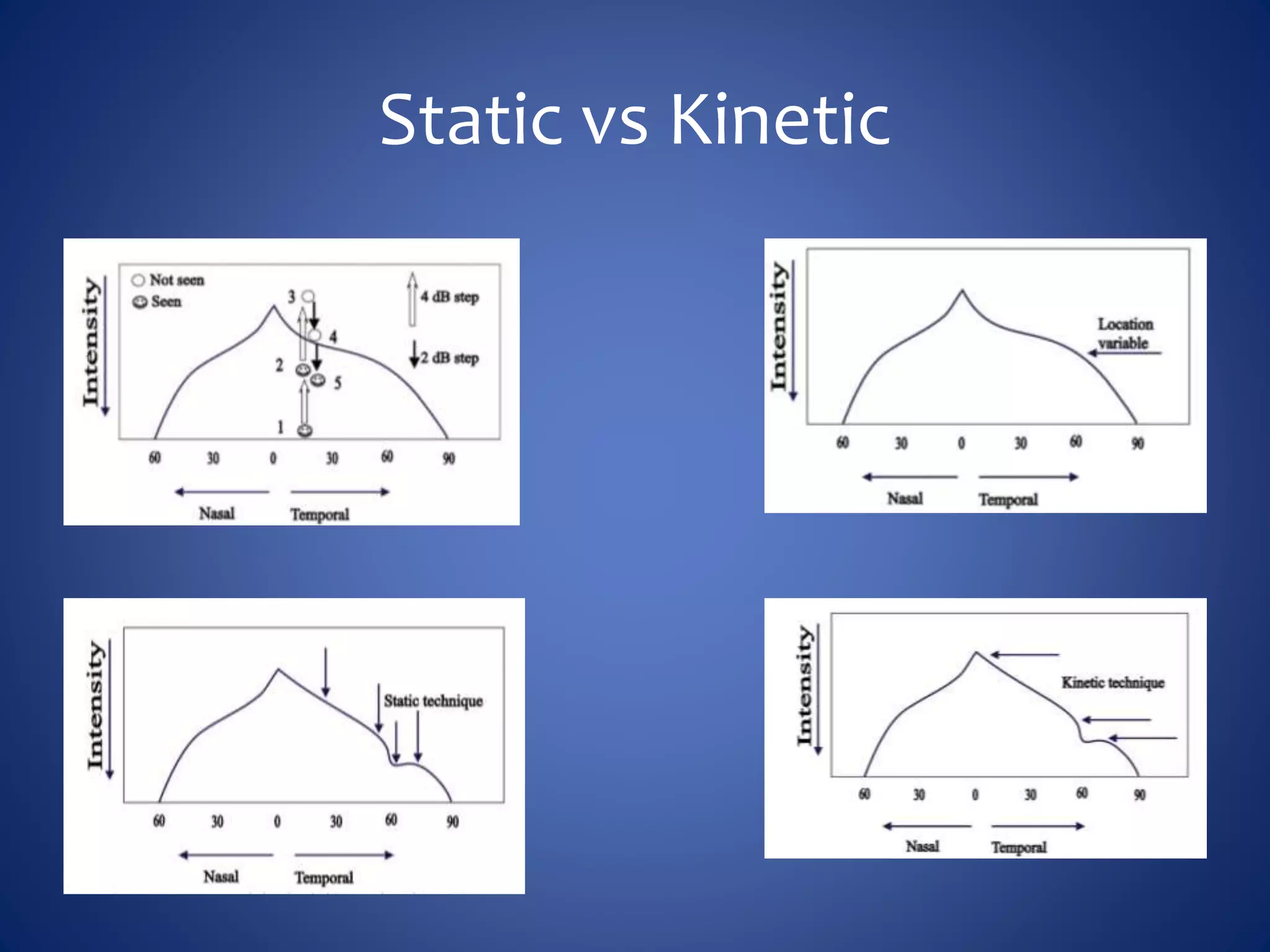 Static vs Kinetic
 