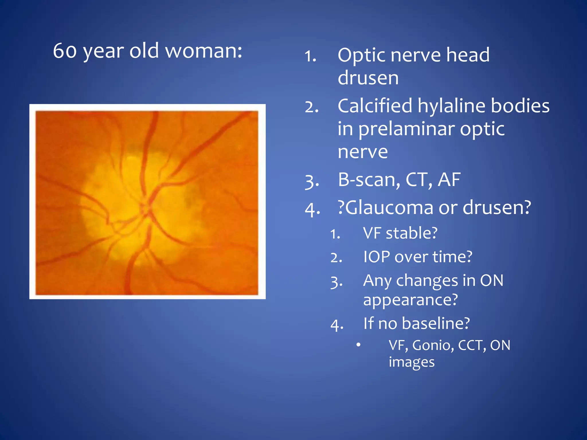 60 year old woman: 1. Optic nerve head
drusen
2. Calcified hylaline bodies
in prelaminar optic
nerve
3. B-scan, CT, AF
4. ?Glaucoma or drusen?
1. VF stable?
2. IOP over time?
3. Any changes in ON
appearance?
4. If no baseline?
• VF, Gonio, CCT, ON
images
 