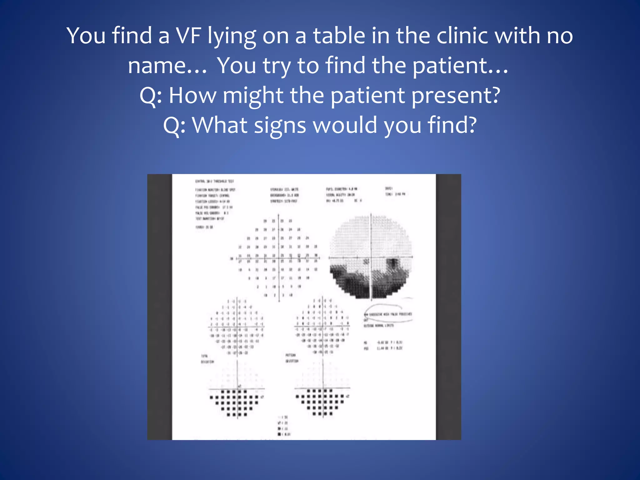 You find a VF lying on a table in the clinic with no
name… You try to find the patient…
Q: How might the patient present?
Q: What signs would you find?
 