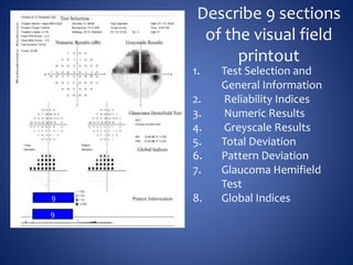 Visual Field Quiz | PPTX