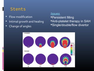 Stents
 Flow modification
 Intimal growth and healing
 Change of angles
Issues
Persistent filling
Anti-platelet therapy in SAH
Single/double/flow divertor
 
