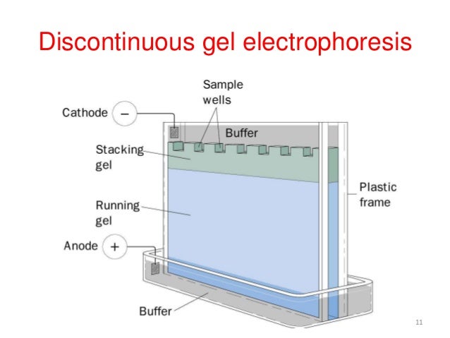 vertical gel electrophoresis sds page sds page