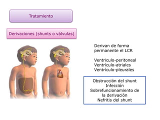Tratamiento
Derivaciones (shunts o válvulas)
Derivan de forma
permanente el LCR
Ventriculo-peritoneal
Ventrículo-atriales
Ventrículo-pleurales
Obstrucción del shunt
Infección
Sobrefuncionamiento de
la derivación
Nefritis del shunt
 