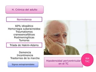 Hipodensidad periventricular
en el TC
H. Crónica del adulto
Normotensa
60% idiopático
Hemorragia subaracnoidea
Traumatismos
craneoencefálicos
Postmeningíticas
Tumores
Tríada de Hakim-Adams
Demencia
Incontinencia
Trastornos de la marcha
Signos extrapiramidales
RM
TAC
 