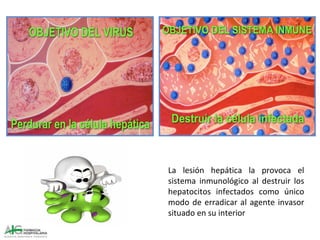 La lesión hepática la provoca el
sistema inmunológico al destruir los
hepatocitos infectados como único
modo de erradicar al agente invasor
situado en su interior
 