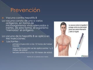 Virus de hepatitis B con caso clínico | PPTX