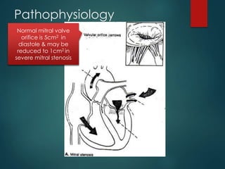 Pathophysiology
 