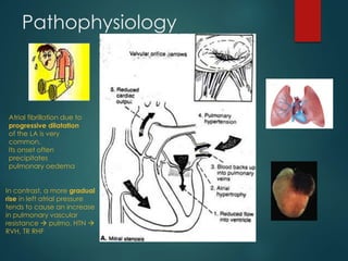 Pathophysiology
Narrowing of mitral valve
 CO
O2/CO2 exchange
(fatigue, dyspnea,
orthopnea)
Left ventricular
atrophy
pul...