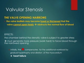 Valvular Stenosis
THE VALVE OPENING NARROWS
 the valve leaflets may become fused or thickened that the
valve cannot open ...