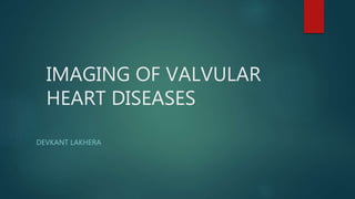 IMAGING OF VALVULAR
HEART DISEASES
DEVKANT LAKHERA
 