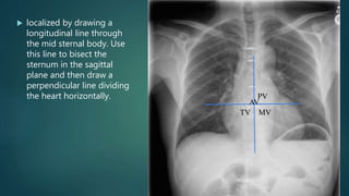  localized by drawing a
longitudinal line through
the mid sternal body. Use
this line to bisect the
sternum in the sagittal
plane and then draw a
perpendicular line dividing
the heart horizontally.
 