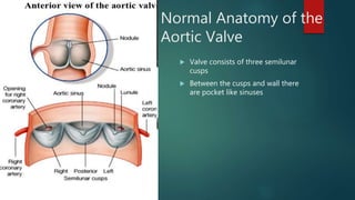 Normal Anatomy of the
Aortic Valve
 Valve consists of three semilunar
cusps
 Between the cusps and wall there
are pocket like sinuses
 