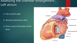 Assessing the chamber enlargement :
Left atrium
 Has smooth walls
 Receives pulmonary veins
 Forms most of the base of the
heart
 