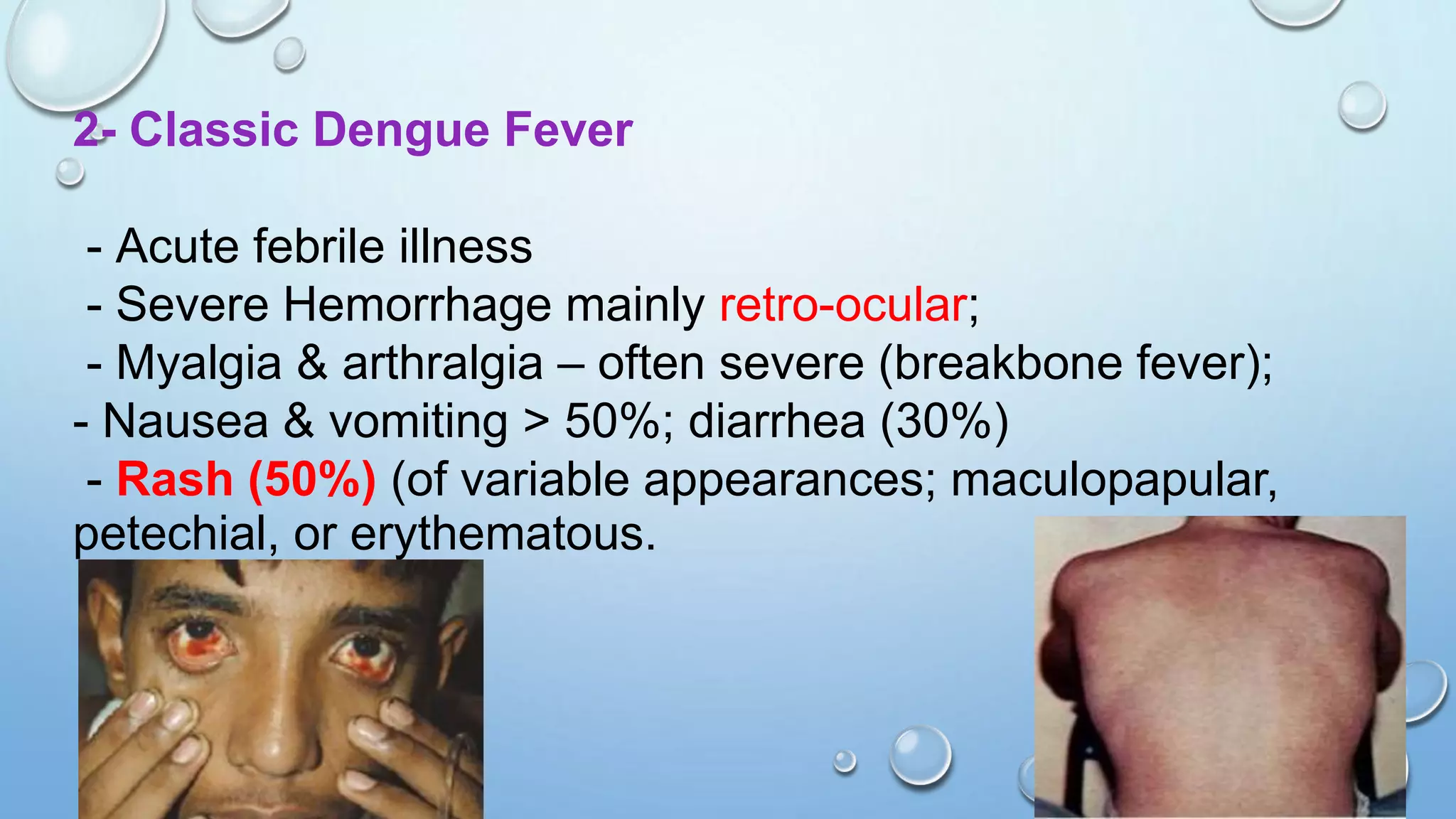 Viral Hemorrhagic Fevers | PPT