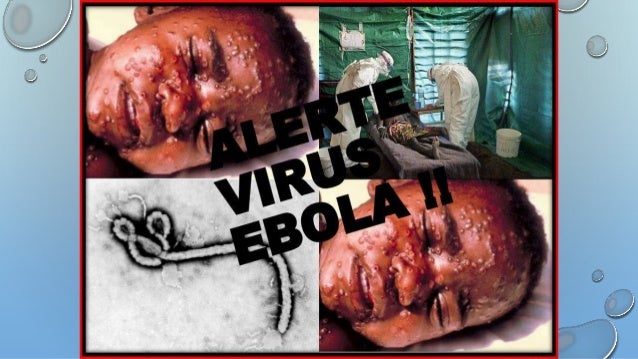 Viral Hemorrhagic Fevers