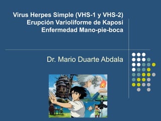 Virus Herpes Simple (VHS-1 y VHS-2)
Erupción Varioliforme de Kaposi
Enfermedad Mano-pie-boca

Dr. Mario Duarte Abdala

 