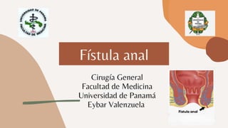 Fístula anal
Cirugía General
Facultad de Medicina
Universidad de Panamá
Eybar Valenzuela
 