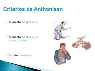 Vi.2. epoc reagudizado | PPT