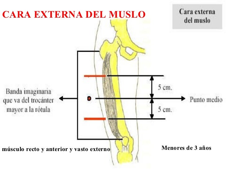 Vía Parenteral