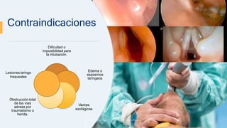 Dificultad o
imposibilidad para
la intubación.
Edema o
espasmos
laríngeos
Varices
esofágicas
Obstruccióntotal
de las vías
aéreas por
traumatismo o
herida.
Lesiones laringo
traqueales
Contraindicaciones
 
