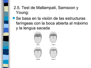 2.5. Test de Mallampati, Samsoon y
  Young:
 Se basa en la visión de las estructuras
  faríngeas con la boca abierta al máximo
  y la lengua sacada
 