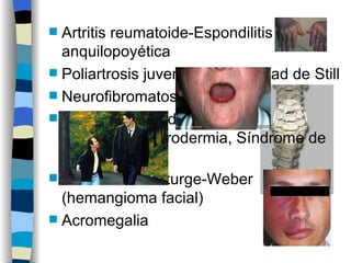  Artritis reumatoide-Espondilitis
  anquilopoyética
 Poliartrosis juvenil o enfermedad de Still
 Neurofibromatosis
 Enfermedades del
  colágeno:esclerodermia, Síndrome de
  CREST
 Síndrome de Sturge-Weber
  (hemangioma facial)
 Acromegalia
 