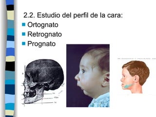 2.2. Estudio del perfil de la cara:  Ortognato Retrognato Prognato 