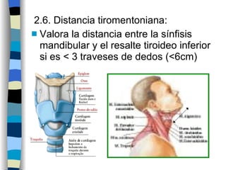 2.6. Distancia tiromentoniana: Valora la distancia entre la sínfisis mandibular y el resalte tiroideo inferior si es < 3 traveses de dedos (<6cm) 