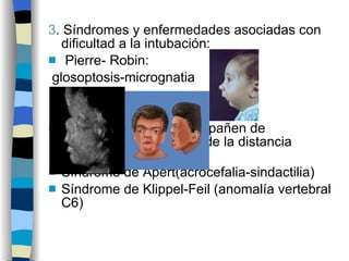 3 . Síndromes y enfermedades asociadas con dificultad a la intubación: Pierre- Robin: glosoptosis-micrognatia Síndromes que se acompañen de disminución o aumento de la distancia intraocular Síndrome de Apert(acrocefalia-sindactilia) Síndrome de Klippel-Feil (anomalía vertebral C6) 
