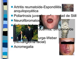 Artritis reumatoide-Espondilitis anquilopoyética Poliartrosis juvenil o enfermedad de Still Neurofibromatosis Enfermedades del colágeno:esclerodermia, Síndrome de CREST Síndrome de Sturge-Weber (hemangioma facial) Acromegalia 