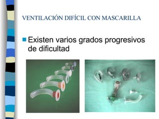 VENTILACIÓN DIFÍCIL CON MASCARILLA Existen varios grados progresivos de dificultad 
