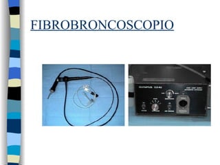 FIBROBRONCOSCOPIO 