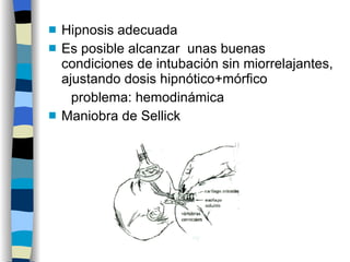 Hipnosis adecuada Es posible alcanzar  unas buenas condiciones de intubación sin miorrelajantes, ajustando dosis hipnótico+mórfico problema: hemodinámica Maniobra de Sellick 